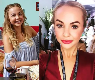 Has Bachelorette Angie Kent had a plastic surgery blitz? A cosmetic surgeon weighs in