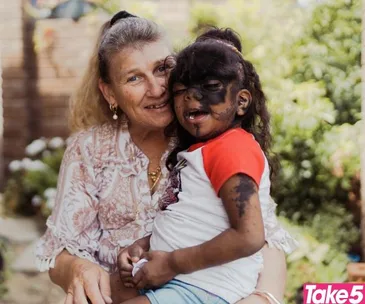 Real life: My girl has one of the rarest medical conditions on the planet but she won’t let it slow her down