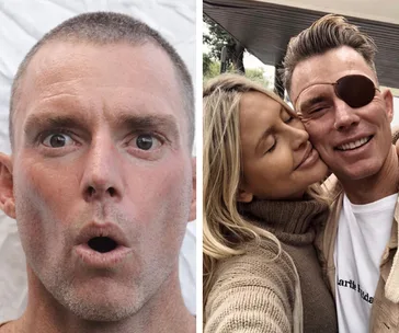 Man with a surprised look, and same man with an eye patch smiling with a woman hugging him.