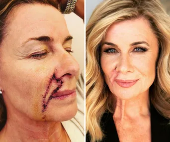 Deborah Hutton shares a photo update following her frightening health scare: “I’m healing well”