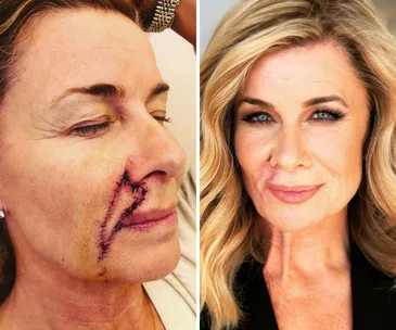 Deborah Hutton shares a photo update following her frightening health scare: “I’m healing well”
