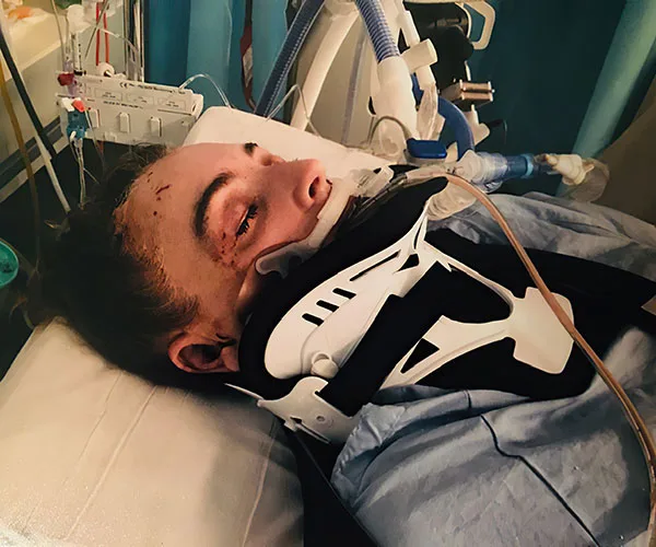 A person in a hospital bed with a neck brace and medical equipment, appearing unconscious.