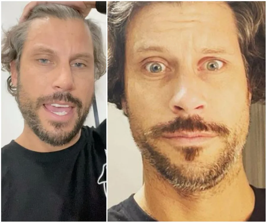 Two side-by-side images of a person with a beard and medium-length hair, looking at the camera.