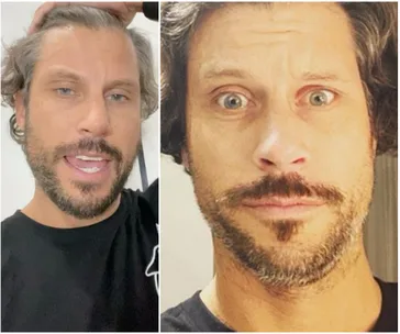 Two side-by-side images of a person with a beard and medium-length hair, looking at the camera.