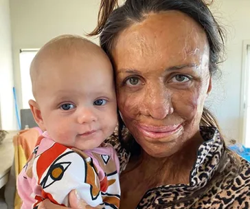 Turia Pitt son