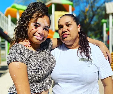 Woman with vitiligo and another woman embracing outdoors, smiling at the camera in a sunny setting.