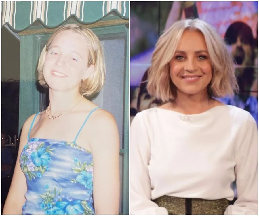 Side-by-side images: a young woman in a blue floral dress on the left, the same woman later in life smiling in a white top on the right.