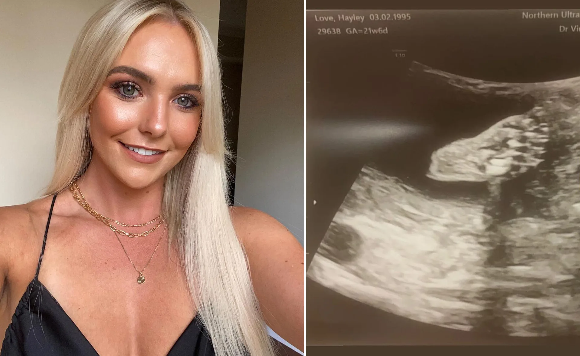 Blonde woman smiling, wearing a black top and gold necklaces, next to an ultrasound image.