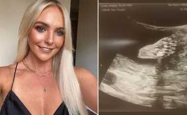 Blonde woman smiling, wearing a black top and gold necklaces, next to an ultrasound image.