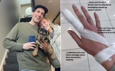 "Couple smiling with dog on stairs; hand with bandaged finger and humorous text about injury and doctoring."