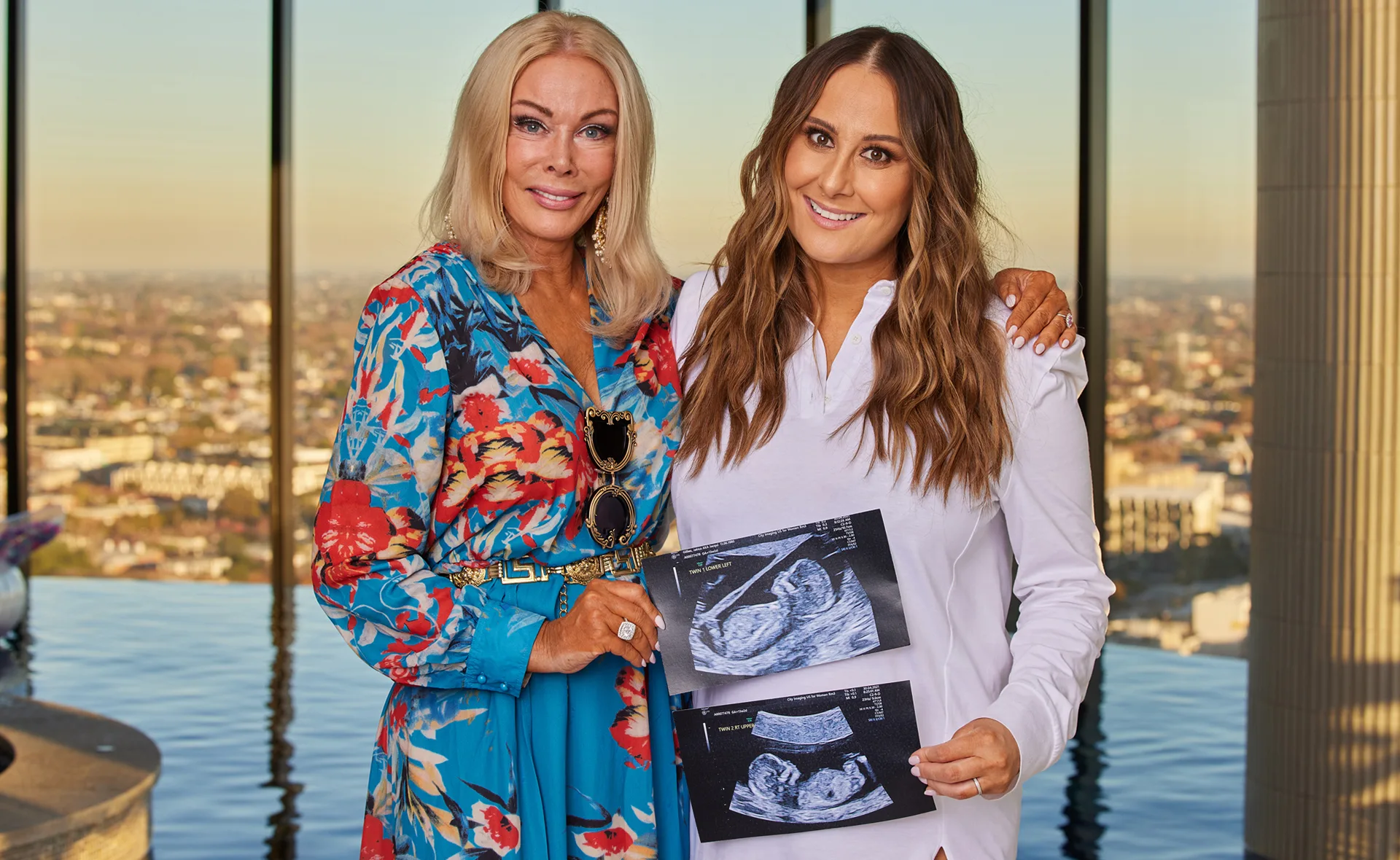 Two women smiling and holding ultrasound images, standing in front of a large window with a cityscape in the background.