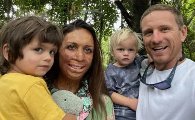 Turia Pitt and Michael Hoskin
