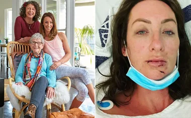 Gogglebox star Isabelle Silbery suffers facial injuries and a broken jaw after a horrific Christmas accident