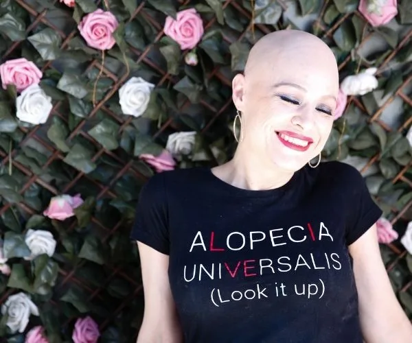 A smiling woman with alopecia in a black shirt that reads "ALOPECIA UNIVERSALIS (Look it up)" against a floral background.