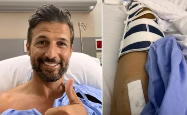 Man in hospital bed giving thumbs up, with injured leg in brace beside him.