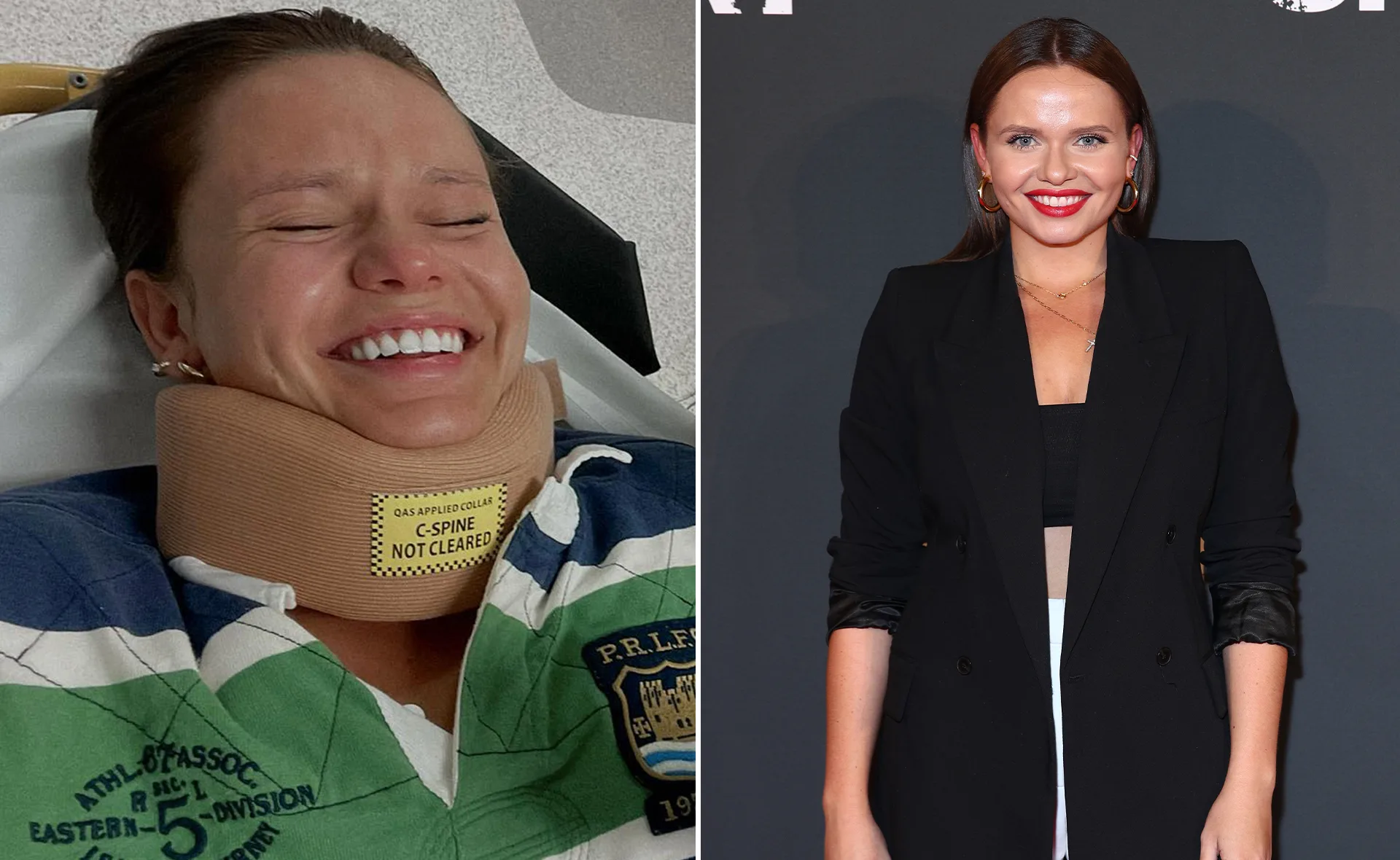 "Two images: left, woman smiling with neck brace; right, same woman smiling at an event in a black outfit."