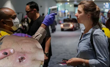 "Person gets temperature checked at airport, inset of skin lesions on hand signifies health screening context."