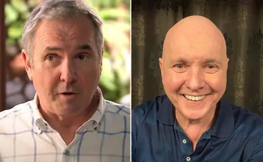 "Side-by-side images of a man with hair and without, smiling in the second."