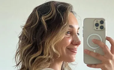 Bachelor runner-up Bella Varelis unveils the results of her surprise plastic surgery