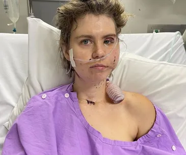 A person in a hospital bed with a nasal cannula and visible medical dressing on the neck, wearing a purple gown.