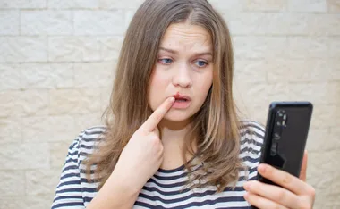Woman pointing at her cold sore