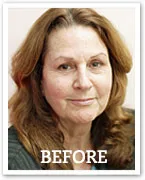 Person with long hair and a neutral expression, labeled "BEFORE".