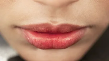 Close-up of lips, slightly dry and cracked, with natural skin tone.