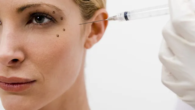 Woman having a collagen injection