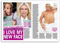 Portraits of a man before and after plastic surgery, smiling in various poses; magazine layout with text highlighting transformation.