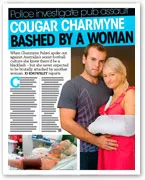 Cougar Charmyne with partner, arm in sling, featured in news article titled "Bashed by a Woman" on pub assault.