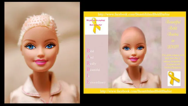 Mattel to make bald Barbie following Facebook campaign