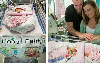 Aussie miracle twins: Our little girls are just adorable