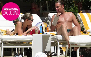 A couple lounges by a pool with sunscreen on a table, one person has a bandaged wrist.