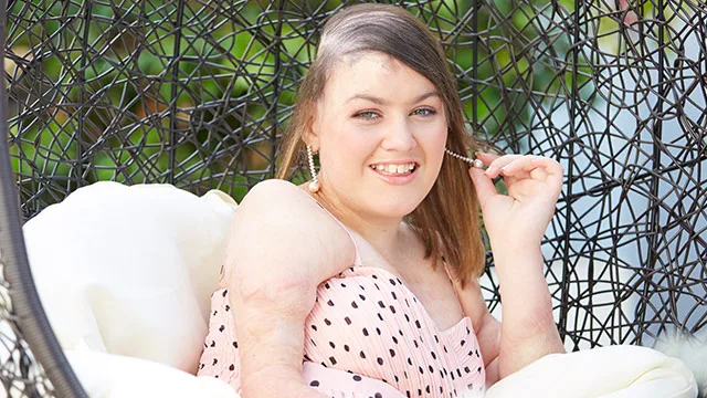 Sophie Delezio smiling in an outdoor wicker chair, wearing a pink polka-dotted dress.