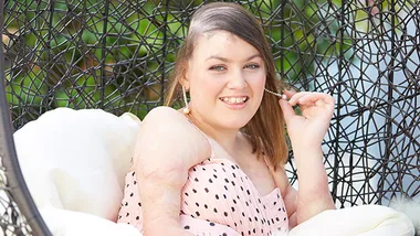 Sophie Delezio smiling in an outdoor wicker chair, wearing a pink polka-dotted dress.