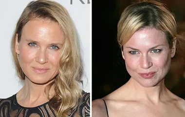 Renee Zellweger’s unrecognisable new face