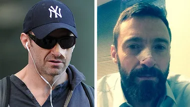 Hugh Jackman wearing a cap and sunglasses; another image shows a bandage on his nose after skin cancer removal.