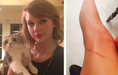A person holds a startled cat; next to them is an image of a scratched leg with a visible red mark.