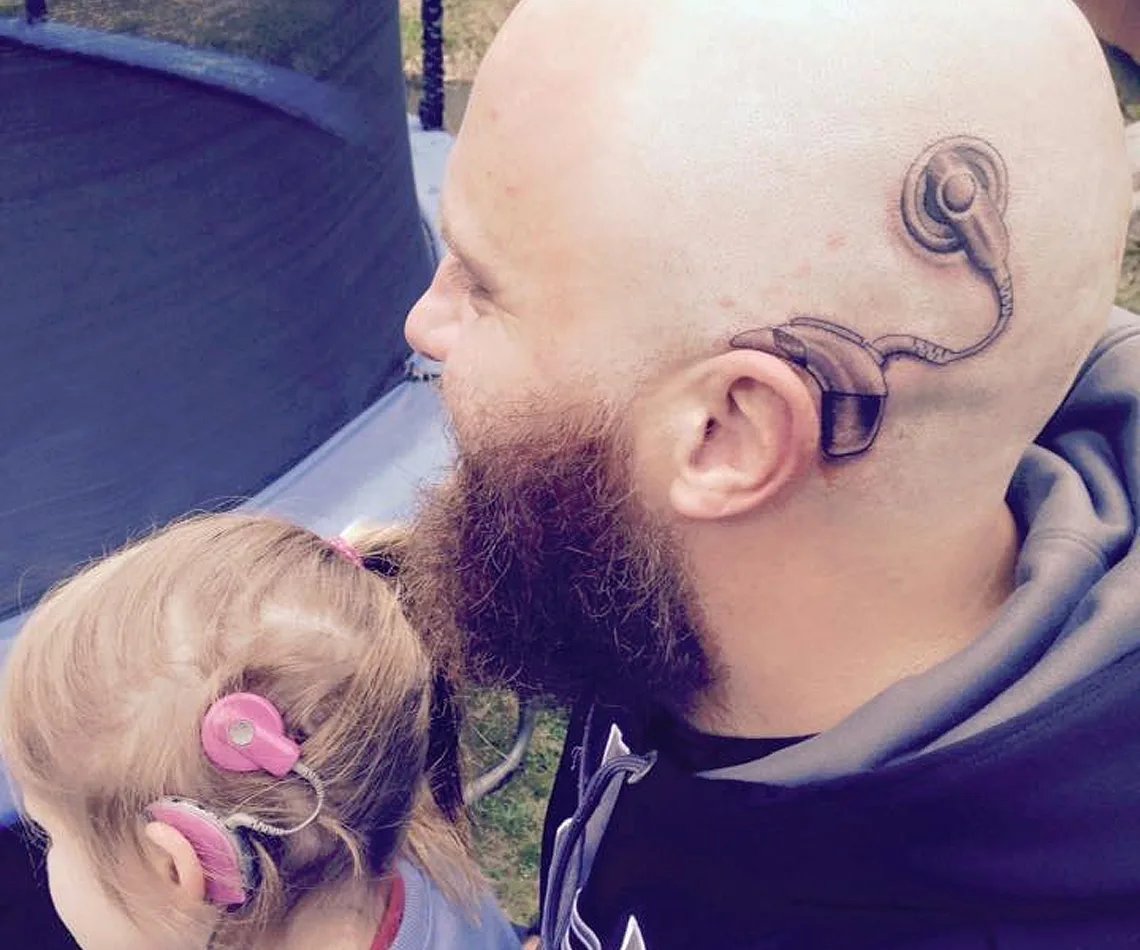 Cochlear implant tattoo