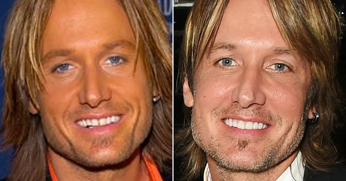 Keith Urban's amazing transformation
