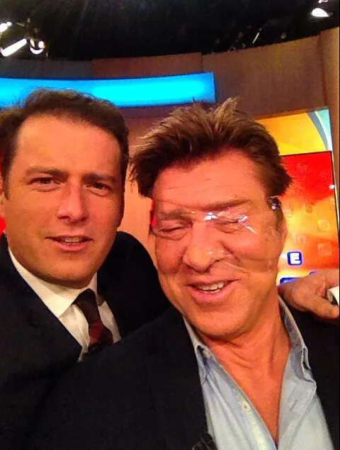 Two men smiling for a selfie on a TV set, one has clear tape across his face.