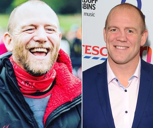 Mike Tindall gets a nose job