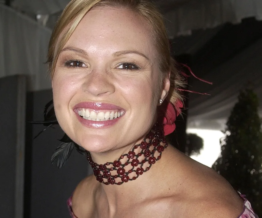 sonia kruger plastic surgery Image 9
