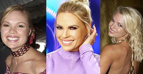 sonia kruger plastic surgery Image 3