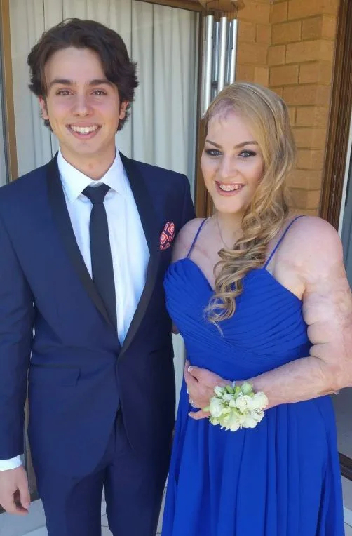 A couple dressed for a formal event, with the woman in a blue dress and the man in a dark suit.