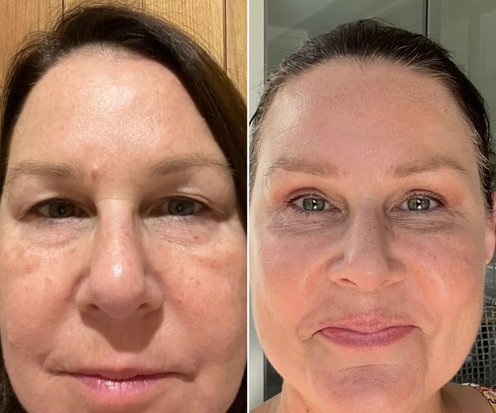 Celebrity plastic surgery procedures How reality TV, MAFS and Instagram have changed the way we