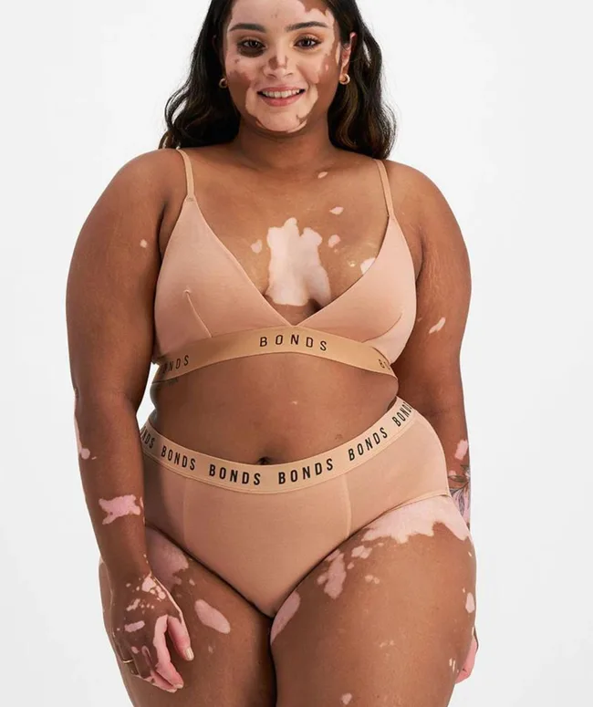 Person wearing beige "Bonds" underwear, with vitiligo visible on their skin, smiling against a plain background.