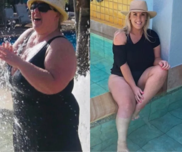 Side-by-side images of a woman's weight loss transformation, showing her before and after significant weight loss.
