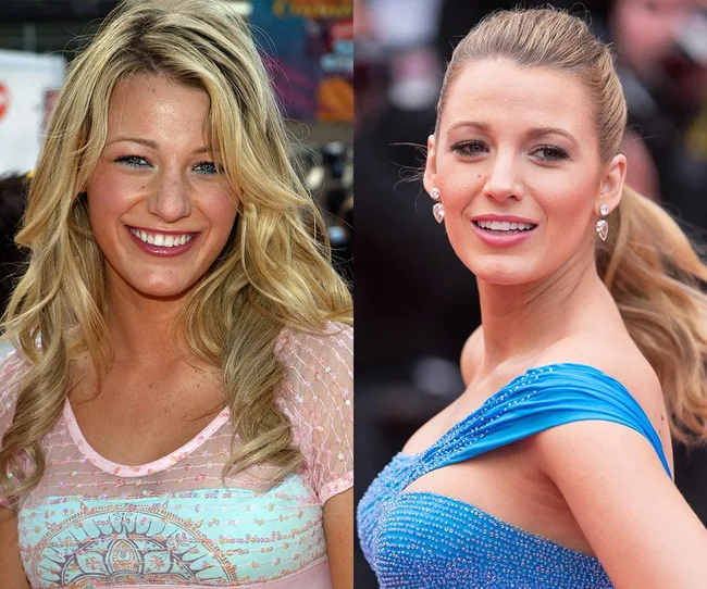 Blake Lively