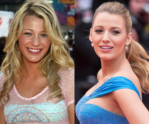 Blake Lively